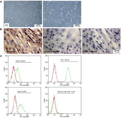 Cocktail of Hyaluronic Acid and Human Amniotic Mesenchymal Cells Effectively Repairs Cartilage Injuries in Sodium Iodoacetate-Induced Osteoarthritis Rats